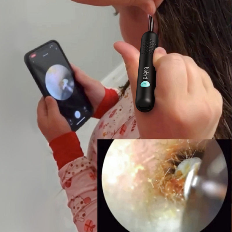 Bebird R1 PLUS Smart Ear Cleaning Stick